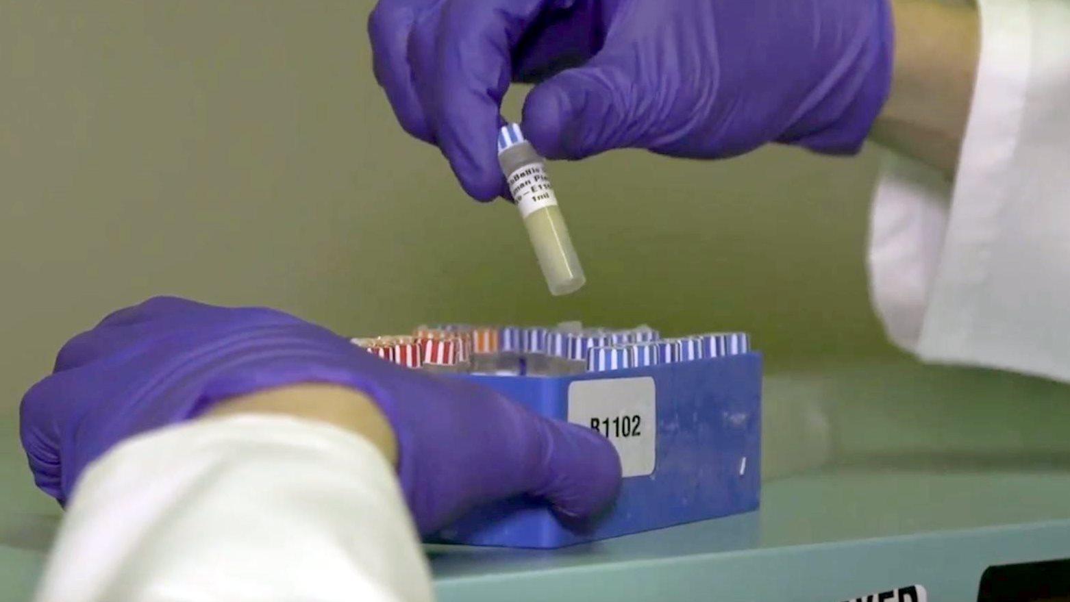 Gloved hands using a pipette with biological samples